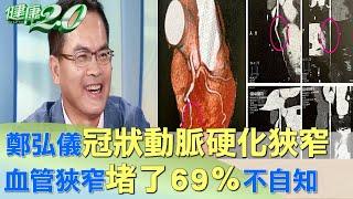 鄭弘儀冠狀動脈硬化狹窄 血管狹窄"堵了69％"不自知 健康2.0