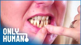 My Husband Has Never Seen My Teeth | Extreme Smile Makeover | Only Human