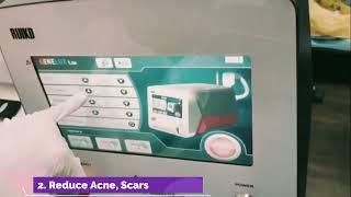 Advance Carbon Laser Treatment In Zirakpur | The Skin Zeal | Dr. Isha V. Mittal (MD)| 72-93-93-93-26