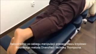 Chiropraktyka. Efekt manipulacji kręgosłupa u pacjentki ze zwyrodnieniem stawów biodrowych.