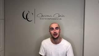 What is Scalp Micropigmentation? Chroma Clinic Scalp Micropigmentation in Vancouver BC Canada.