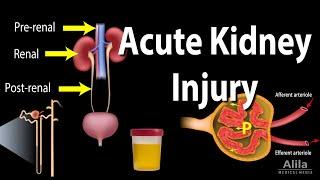 Acute Kidney Injury, a.k.a. Acute Renal Failure, Animation