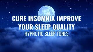 Cure Insomnia Improve Your Sleep Quality | Get Rid of Stress Anxiety Fast | Hypnotic Sleep Tones