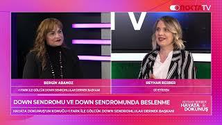 Down Sendromu Hakkında Bilinmeyenler | Belgin Abanoz | Reyhan Berber İle Hayata Dokunuş | 30.11.2024