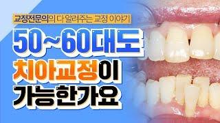 50대, 60대 나이들어도 치아교정이 가능한가요? 어르신 치아교정, 중년 치아교정, 노인교정