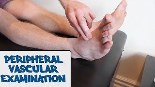 Peripheral Vascular Examination - OSCE Guide  (old version) | UKMLA | CPSA | PLAB 2