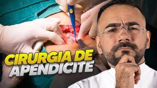 COMO É FEITO A CIRURGIA DE APENDICITE? (APENDICECTOMIA)