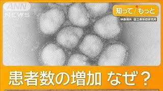 インフルエンザ「pdm09型」猛威　2009年にも大流行　医師「免疫持つ人少ない」【知っておきたい！】【グッド！モーニング】(2024年12月29日)