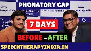 SLP Sanjay Kumar: Pre-Post | Phonatory Gap | Voice Therapy | Within 7 Days | Since 2010