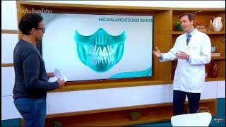 Evolução da dentição e idade ideal para iniciar o tratamento ortodôntico