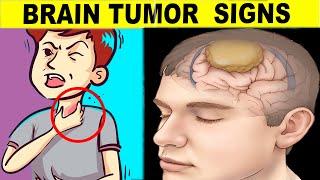 9 Warning Signs You Have A Brain Tumor - Know The Risks!