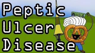 Peptic Ulcer Disease - Learn with Visual Mnemonics!!