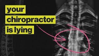 Chiropractors Are Not What You Think They Are