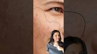 3 Steps To Remove Pigmentation & Hyperpigmentation