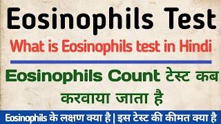 Eosinophils test in hindi | Symptoms, Normal Range & Price of Eosinophils Test