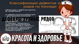 Дефекты зубных рядов