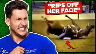 Doctor Reacts To Shocking Horse Riding Injuries