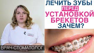 Зачем лечат зубы перед фиксацией брекетов? Почему нельзя потом вылечить зубы?