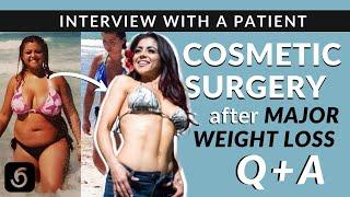 Dr. 6ix patient breaks down entire COSMETIC SURGERY journey after MASSIVE WEIGHT LOSS | SIXSURGERY