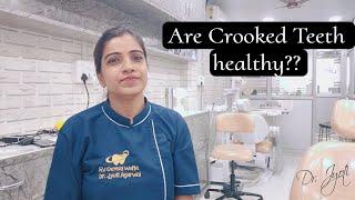 Are Crooked teeth healthy?? | malaligned teeth | unhealthy teeth causes | Dr. Jyoti Agarwal