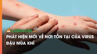 Phát hiện mới về nơi tồn tại của virus đậu mùa khỉ
