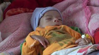 Yemen's starving children, a tragic legacy of war | AFP