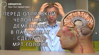 Что такое гидроцефалия головного мозга?  Cимптомы и диагностика