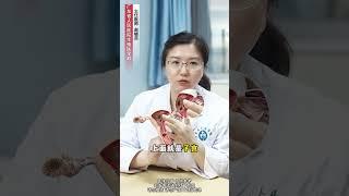 #医学科普 #男性 #女性 #科普一下