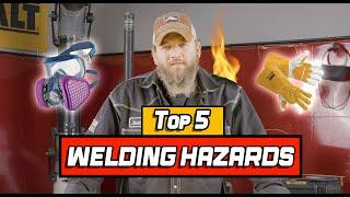 TOP 5 Welding Hazards