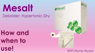 Mesalt : When and how to use