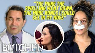 Nesreen’s Nose BENT Sideways After a Botched Nose Job | Botched | E!
