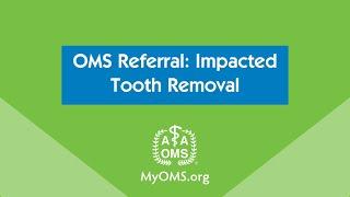 OMS Referral: Impacted Tooth Removal