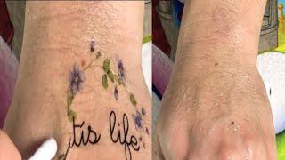 HOW TO REMOVE TATTOOS AT HOME!!! { My experience was more gentle } // Charming tattoo asmr #62