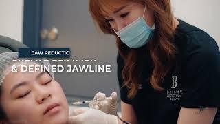 Jaw Reduction Botox | V Shape Face & Jaw Slimming | Become Aesthetics Clinic Singapore