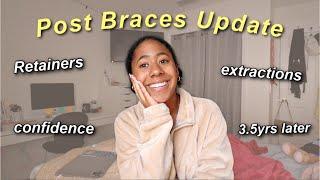 POST BRACES UPDATE!! Retainer talk + Extractions update