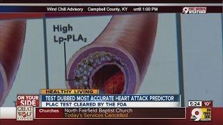 Plac test cleared by FDA can predict heart attack