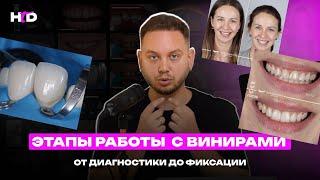 Виниры. Этапы работы | PROвиниры Прокопович Виктор