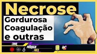 Tipos de Necrose: Gordurosa, liquefativa,  caseosa, gangrenosa, coagulação e fibrinoide [Atualizado]