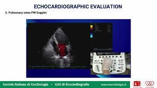 Echo Toolbox: Valutazione Ecocardiografica della Funzione Diastolica