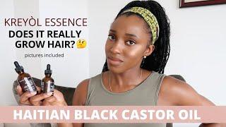 DOES IT GROW HAIR? | Kreyol Essence Haitian Black Castor