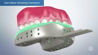 INVISALIGN DENTIST IN CHICAGO