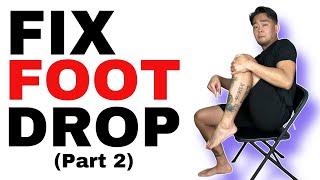 Foot Drop Treatment Part 2