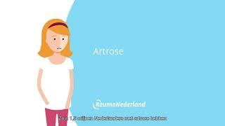 Artrose