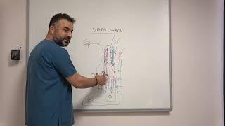 Varis tedavisinde en sevimsiz öneri: VARİS ÇORABI - Prof. Dr. Ahmet AKGÜL