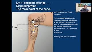 Day 3 Pass Gate for knee pain & Varicose vein ,barrier points 21 July