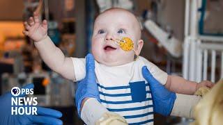 Breakthrough gene editing treatment helps child born with rare disorder