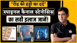 Spinal Canal Stenosis | क्या है स्पाइनल स्टेनोसिस ? जानिए इसके लक्षण और इलाज ! | Dr. Ramdeo Lamoria