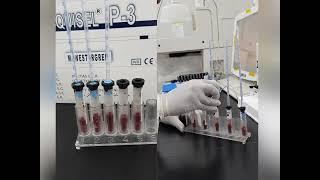 Erythrocyte Sedimentation Rate (ESR)