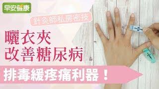 針灸師私房密技！排毒緩疼痛利器，曬衣夾改善糖尿病【早安健康】