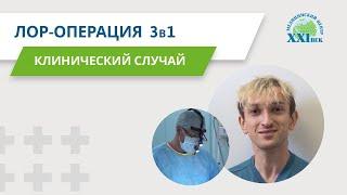 Отзыв пациента после септопластики, двусторонней тонзиллэктомии и вазотомии